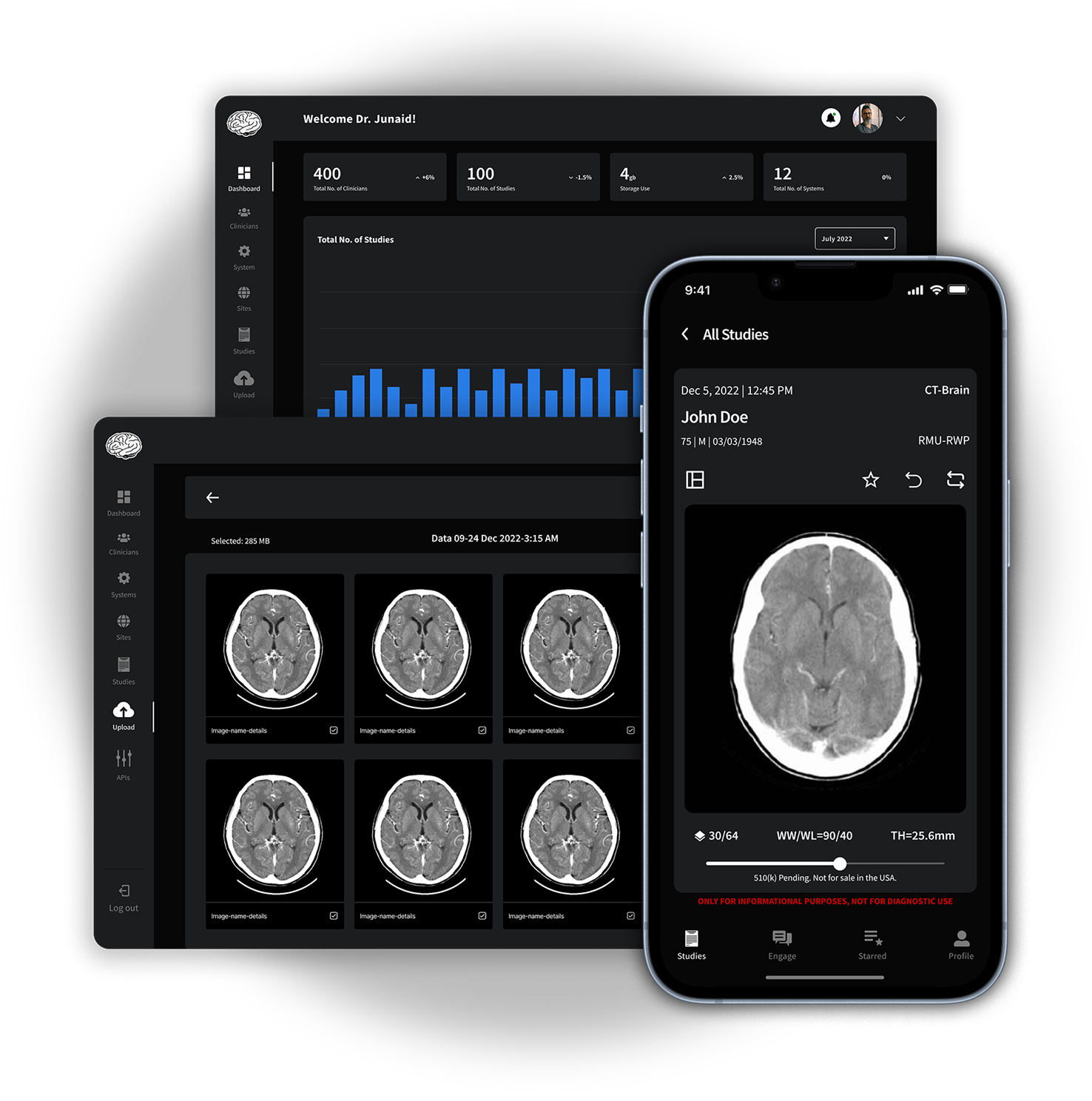 a showcase of brain bleed detect application